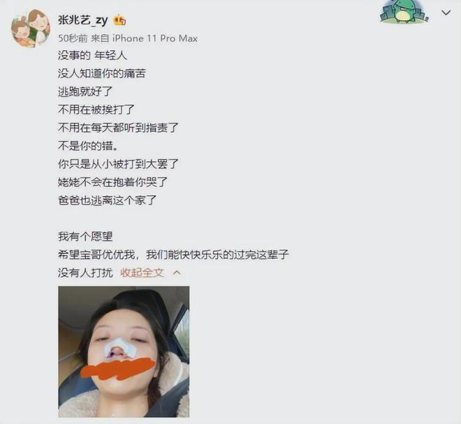 知名童星惨遭亲妈家暴，被板凳砸脸：哪来的“打是亲，骂是爱”？