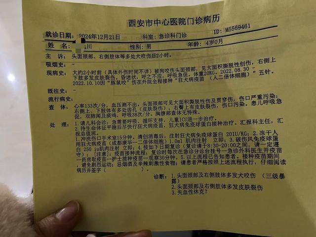 西安一4岁男童被狗咬伤住进ICU 警方：已对犬主刑事拘留｜封面深镜  第3张